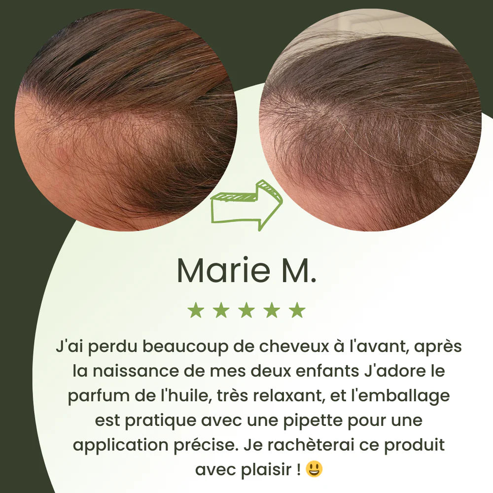 Huile naturelle pour la croissance des cheveux