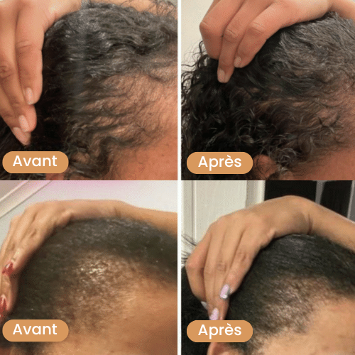 Huile naturelle pour la croissance des cheveux