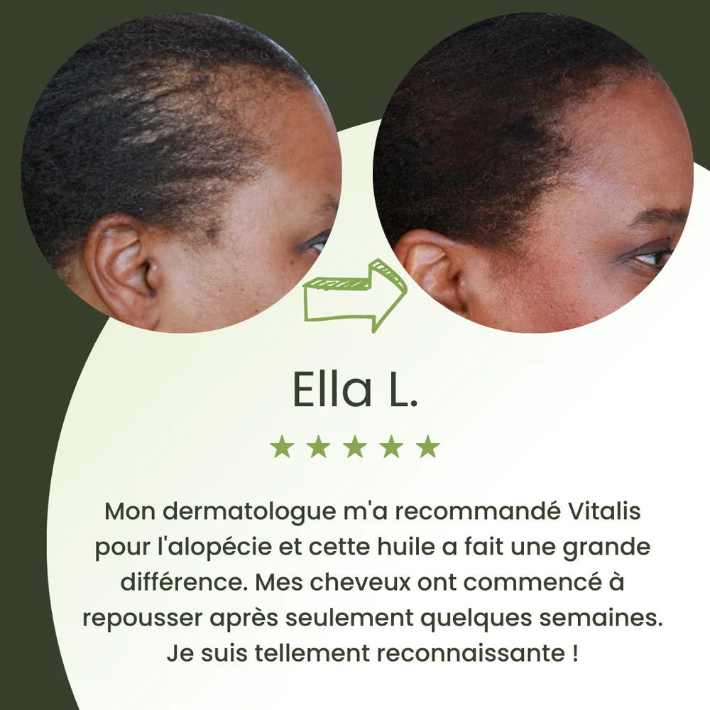 Huile naturelle pour la croissance des cheveux