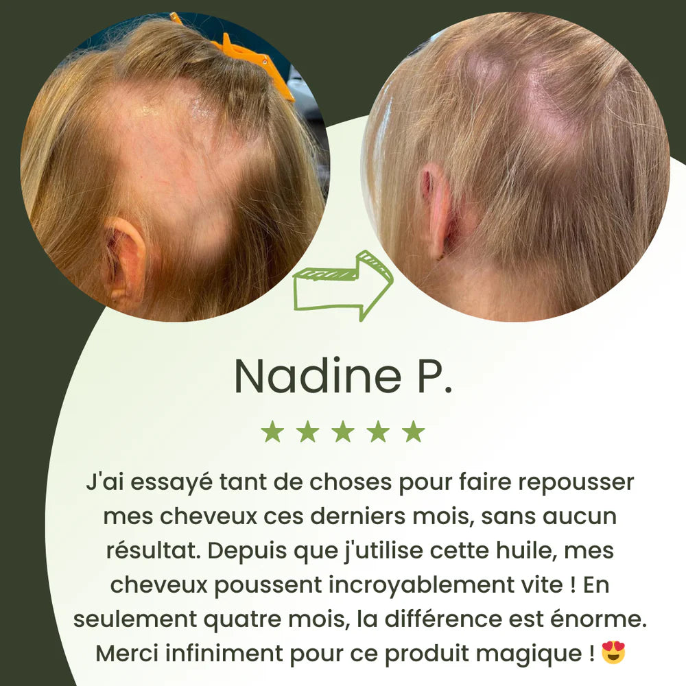 Huile naturelle pour la croissance des cheveux