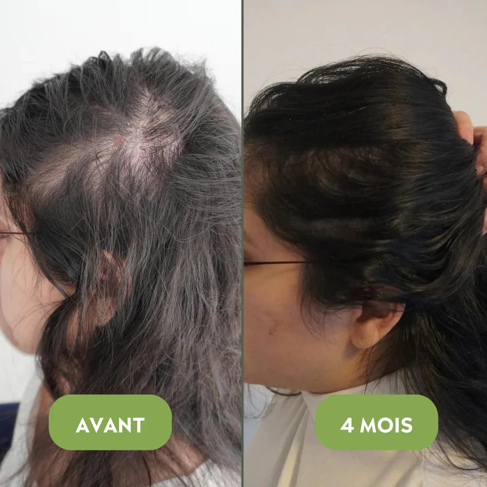 Huile naturelle pour la croissance des cheveux